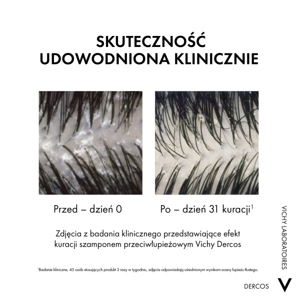Vichy Dercos DS, szampon przeciwłupieżowy z odżywką 2w1, 390 ml