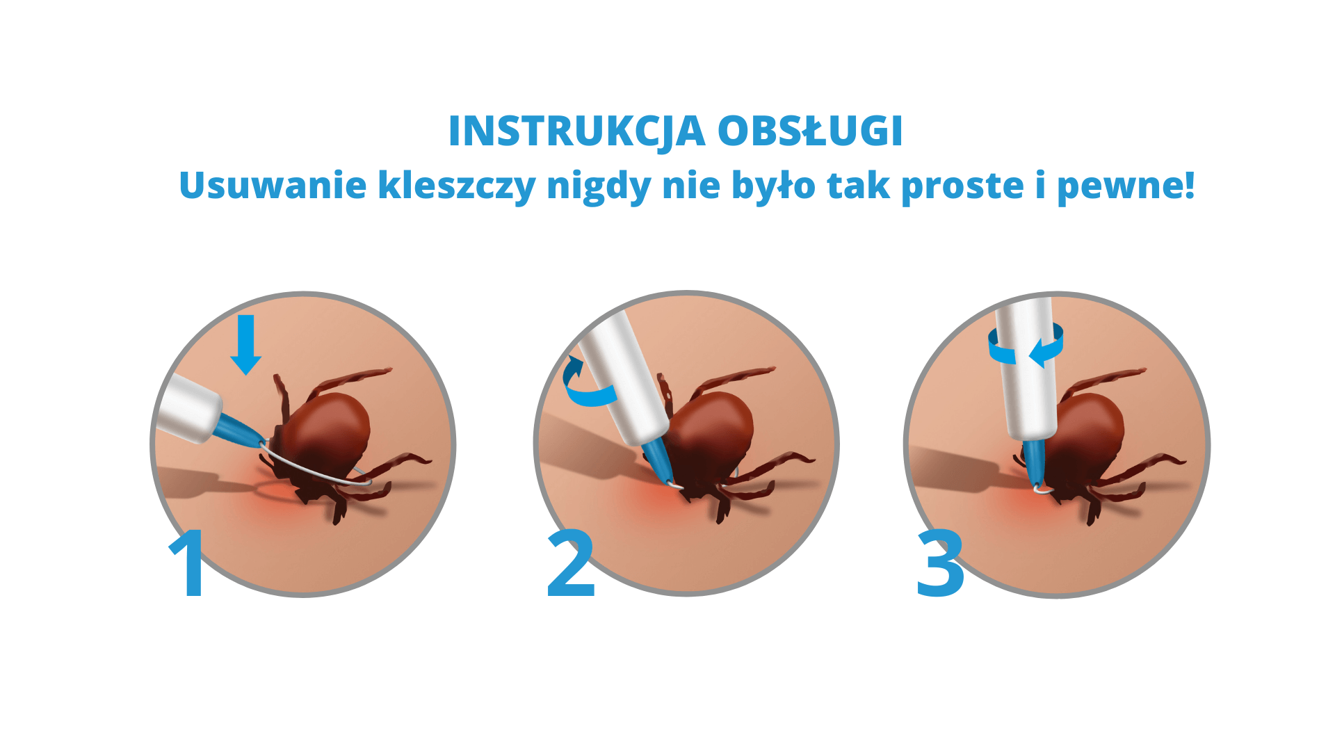 Trix Tick Picker , przyrząd do usuwania kleszczy, 1 szt.