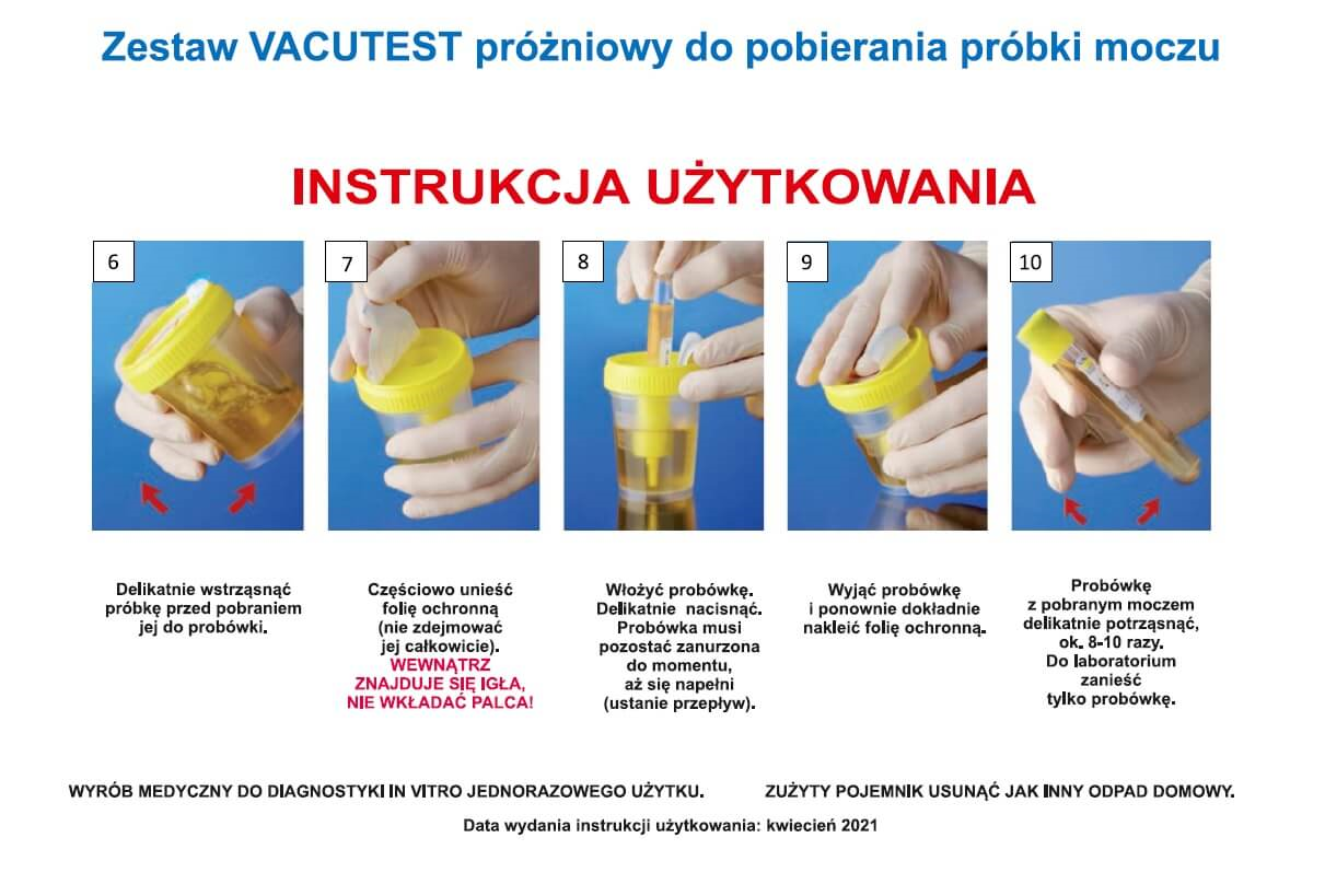 Zestaw VACUTEST próżniowy, do pobierania próbki moczu, 1 szt.