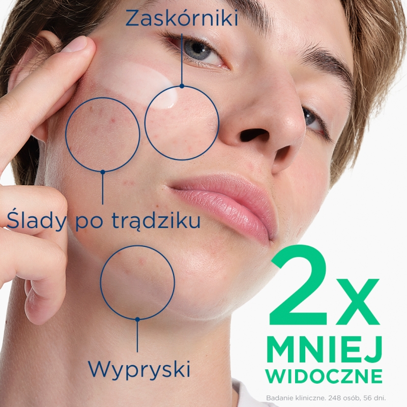 Bioderma Sebium Kerato+, żel-krem, 30 ml