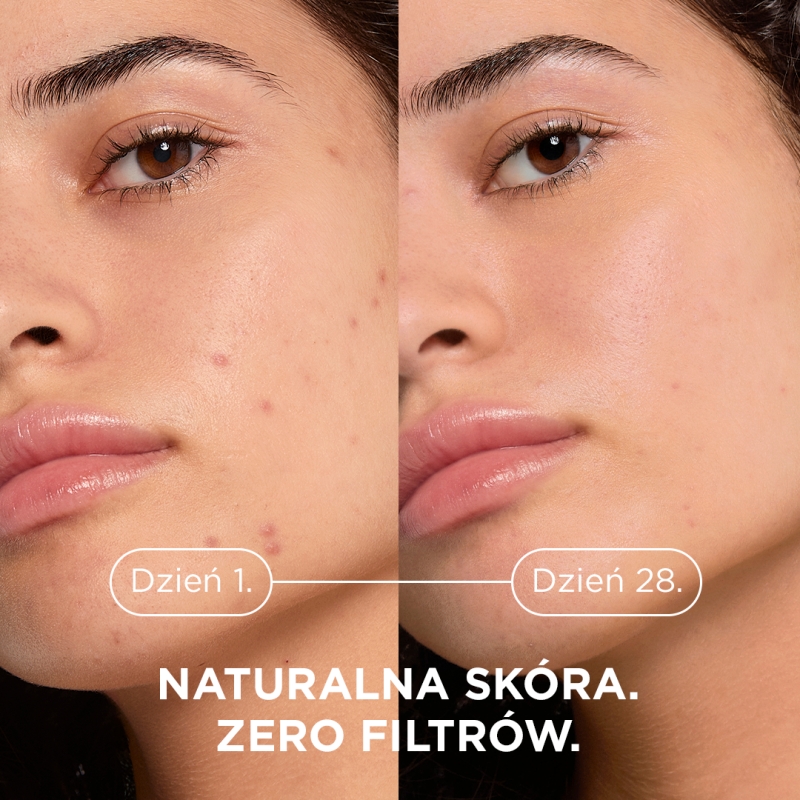 Bioderma Sebium Kerato+, żel-krem, 30 ml