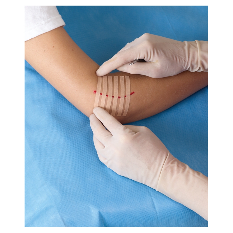 Steri-Strip Paski do zamykania ran, paski beżowe 6 mm x 75 mm, 6 szt.