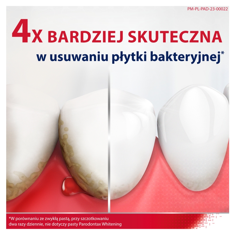 Parodontax, pasta do zębów zapobiegająca krwawieniu dziąseł, 75 ml