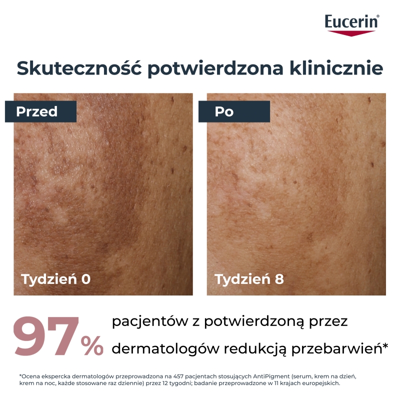 Eucerin Anti-Pigment, krem na dzień przeciw przebarwieniom SPF30, 50 ml