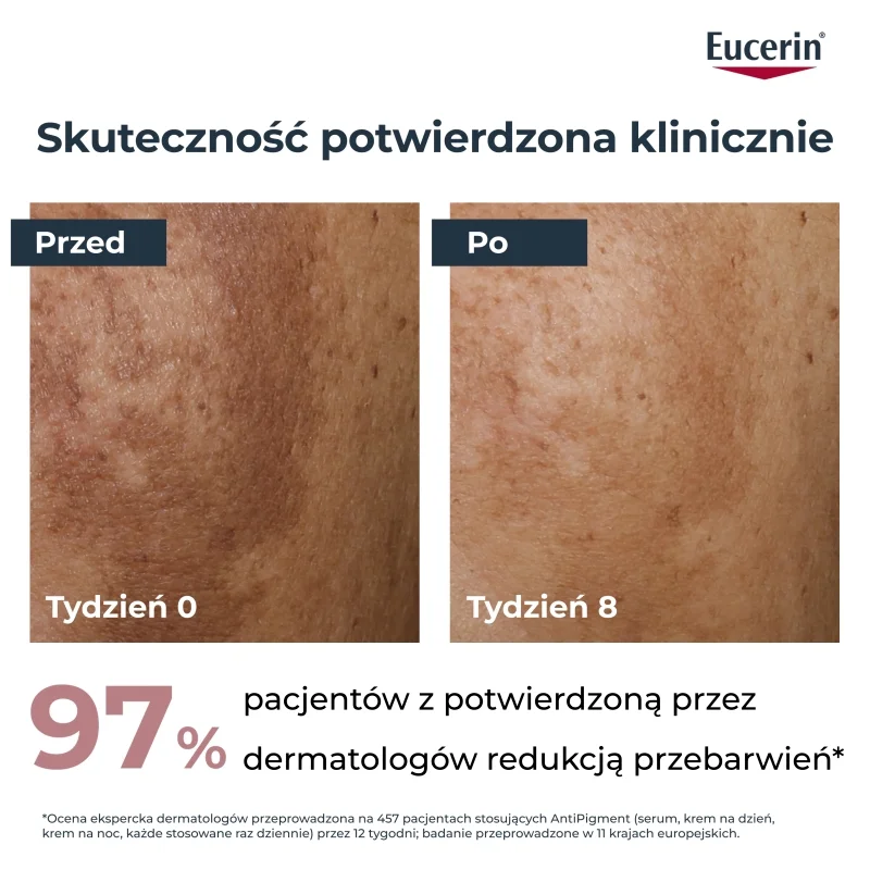 Eucerin Anti-Pigment, krem na noc przeciw przebarwieniom, 50 ml