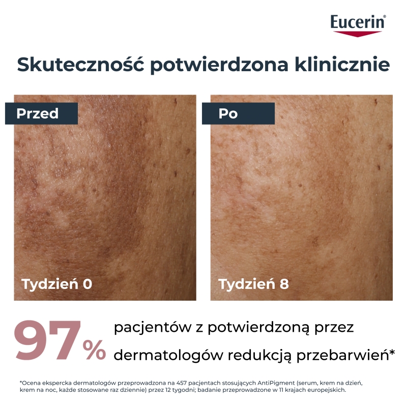 Eucerin Anti-Pigment, krem na noc przeciw przebarwieniom, 50 ml