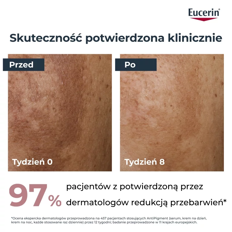 Eucerin Anti-Pigment, serum, 30 ml