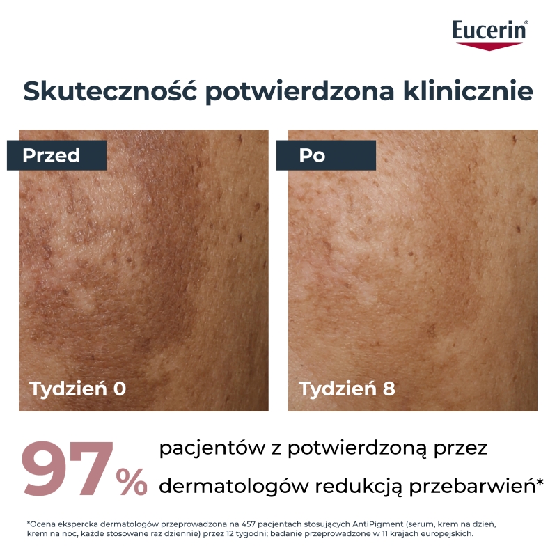 Eucerin Anti-Pigment, serum, 30 ml