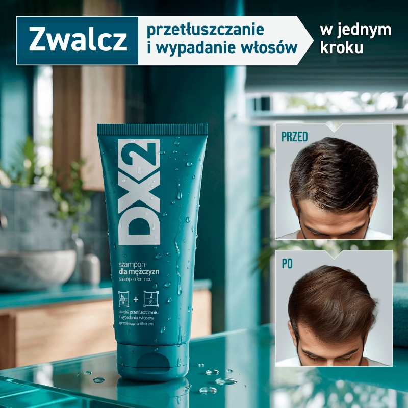 DX2, szampon przeciw przetłuszczaniu i wypadaniu włosów, 150 ml
